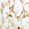 A57, Dermis, 40x (Ag)