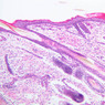 A49, Scalp (Embryo), 10x (H&E)