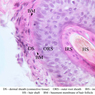 A58, Scalp, 40x Labeled (H&E)