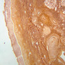 A57, Fingertip, 2.5x (Ag)