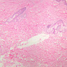 Skin and Sensory Receptors