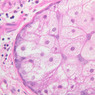 Skin and Sensory Receptors