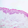 Skin and Sensory Receptors