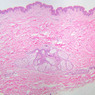 Skin and Sensory Receptors