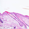 Skin and Sensory Receptors