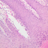 Skin and Sensory Receptors