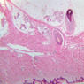 Skin and Sensory Receptors