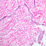 Skin and Sensory Receptors