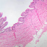 Skin and Sensory Receptors