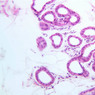 Skin and Sensory Receptors