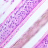 Skin and Sensory Receptors